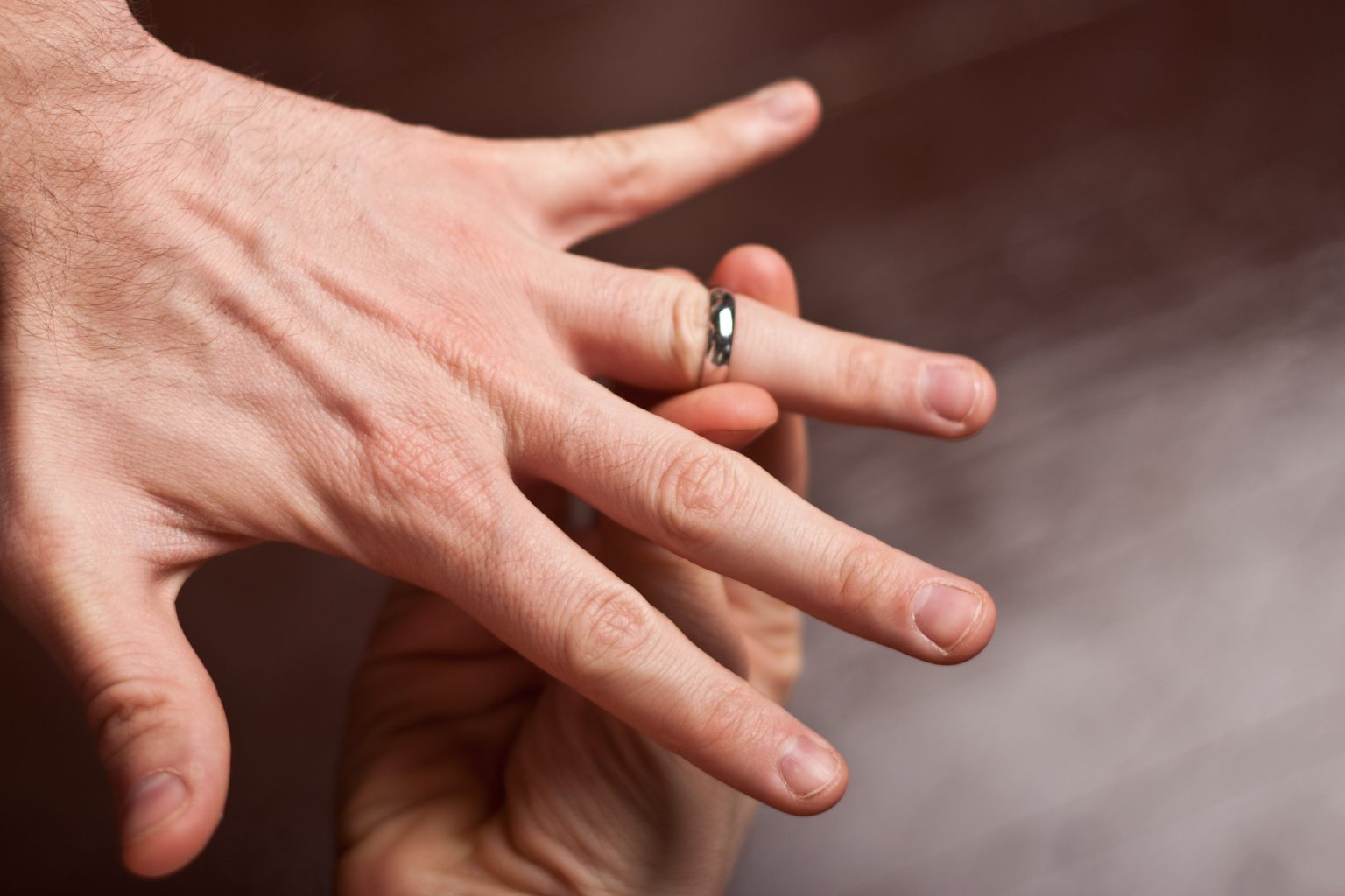 How to get rid of ring indentation on finger
